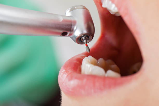 Best Emergency Root Canal Treatment in Bushnell, FL